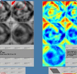 Маммограф МЭМ 20-08
