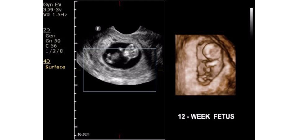 Philips ClearVue 650