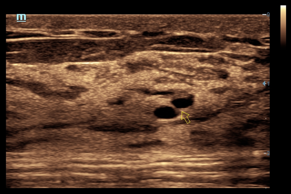 Mindray DC-60 Exp X-Insight