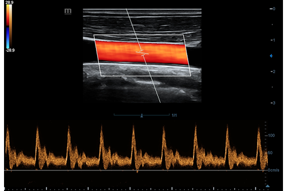 Mindray DC-60 Exp X-Insight