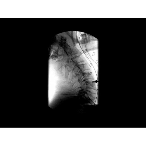Моноблочный рентгенохирургический аппарат GE Brivo OEC 785/865