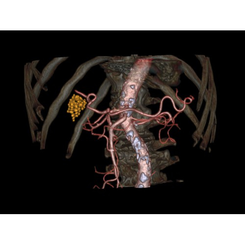 КТ аппарат GE Brivo CT385