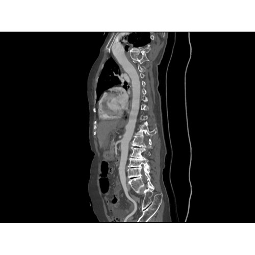 КТ аппарат GE Brivo CT385