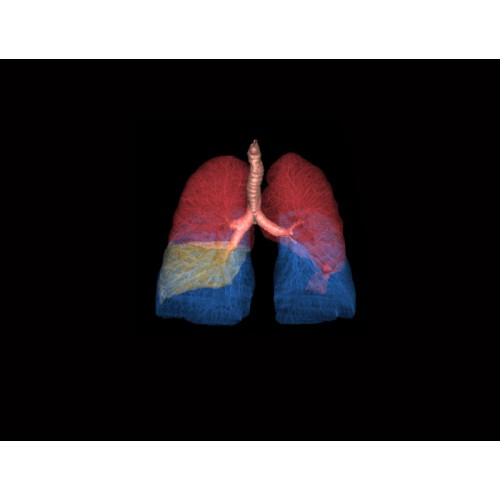 КТ аппарат GE Optima CT540